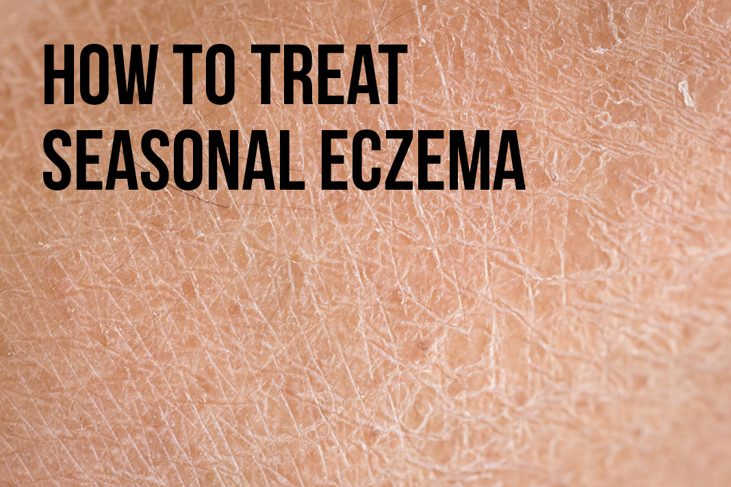 How to Prevent and Treat Seasonal Eczema