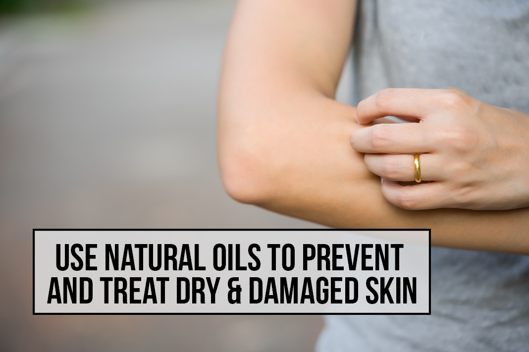 How to Use Natural Oils to Prevent and Treat Dry Skin