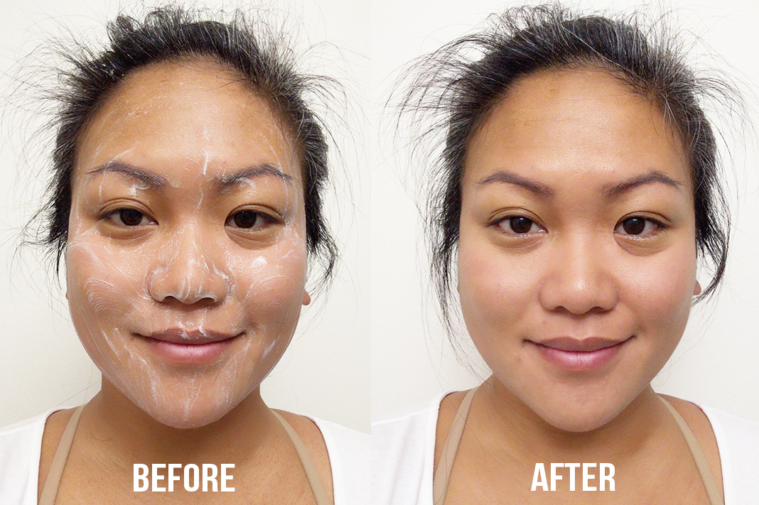ASDM Micro salicylic cleanser before and after | Schimiggy Reviews